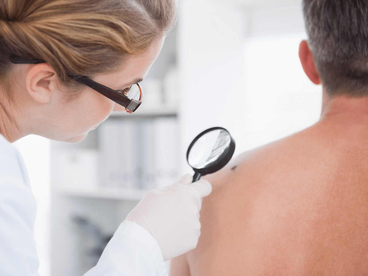 A female dermatologist examining a mole on a male patient's back.